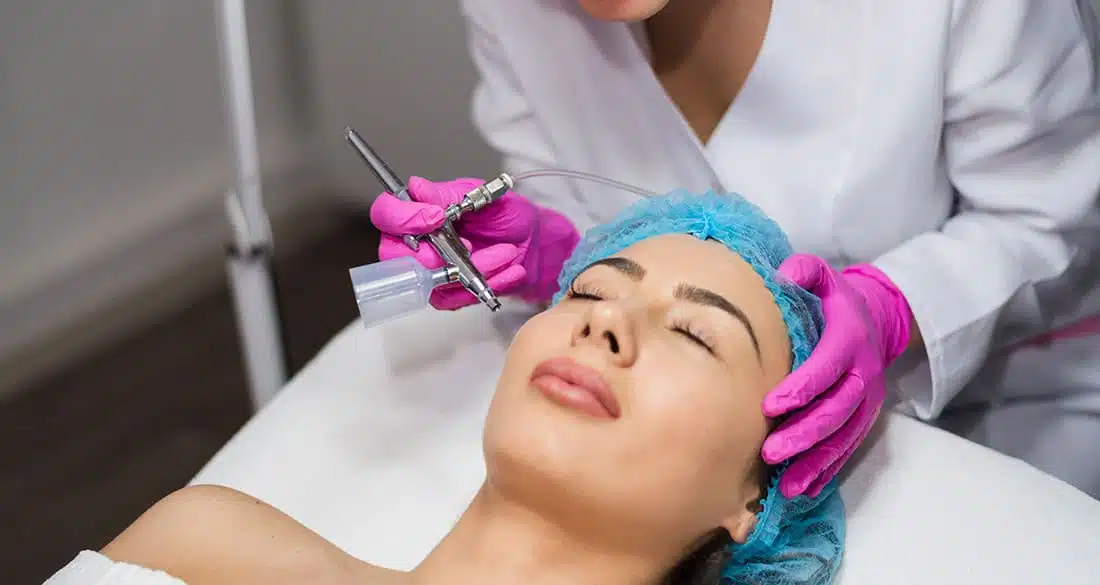 Step by step guide on microneedling by Dermapen4