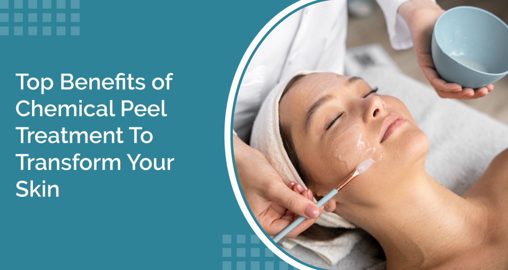 Top Benefits of Chemical Peel Treatment