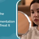 Discover the Causes of Hyperpigmentation & How to Treat It