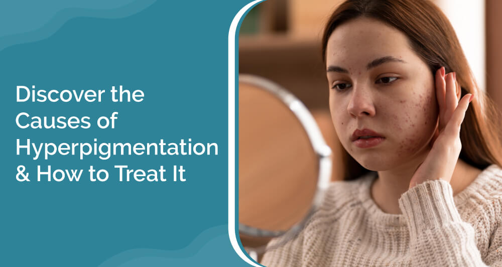 causes of hyperpigmentation