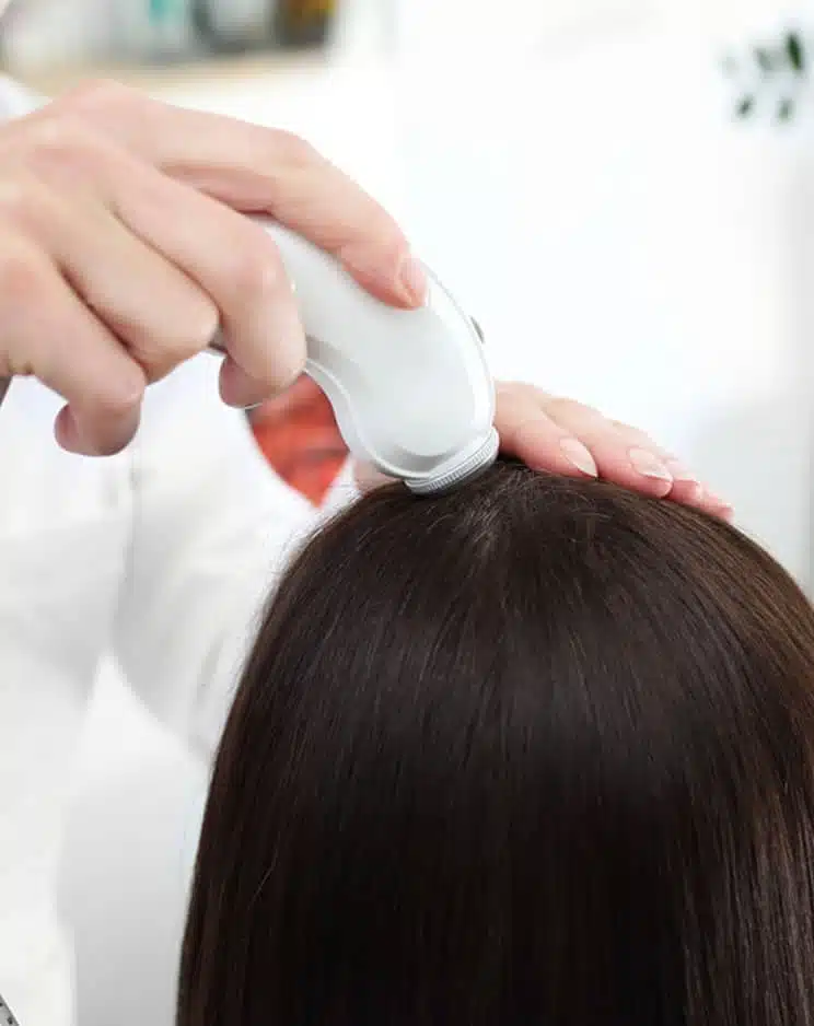 excess hair growth treatment