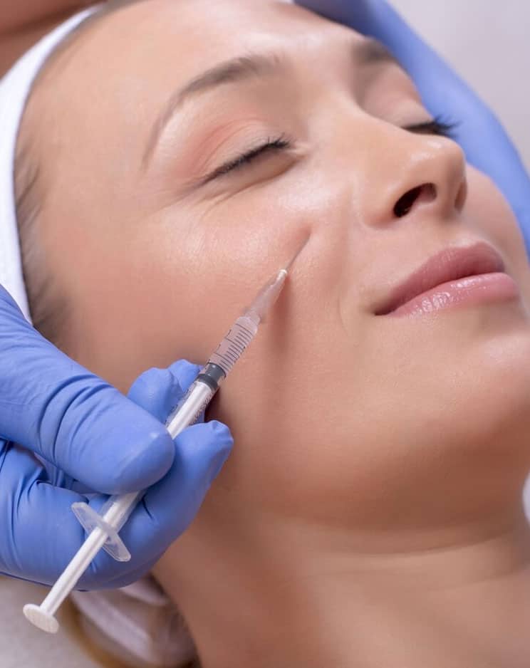 fillers treatment