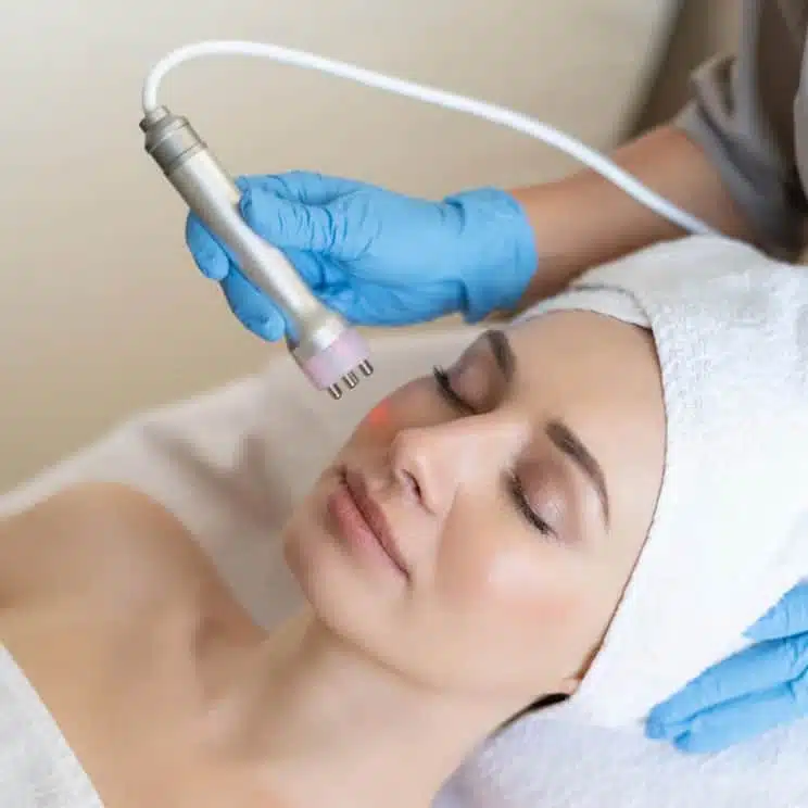 laser pigmentation treatment